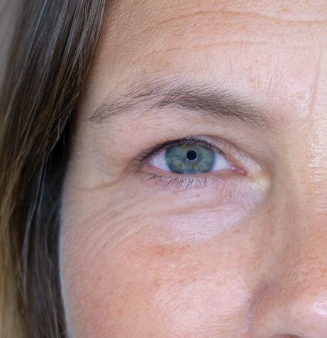 Før og etter Browshape-behandling